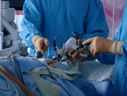 Esku-hartze kirurgikoa